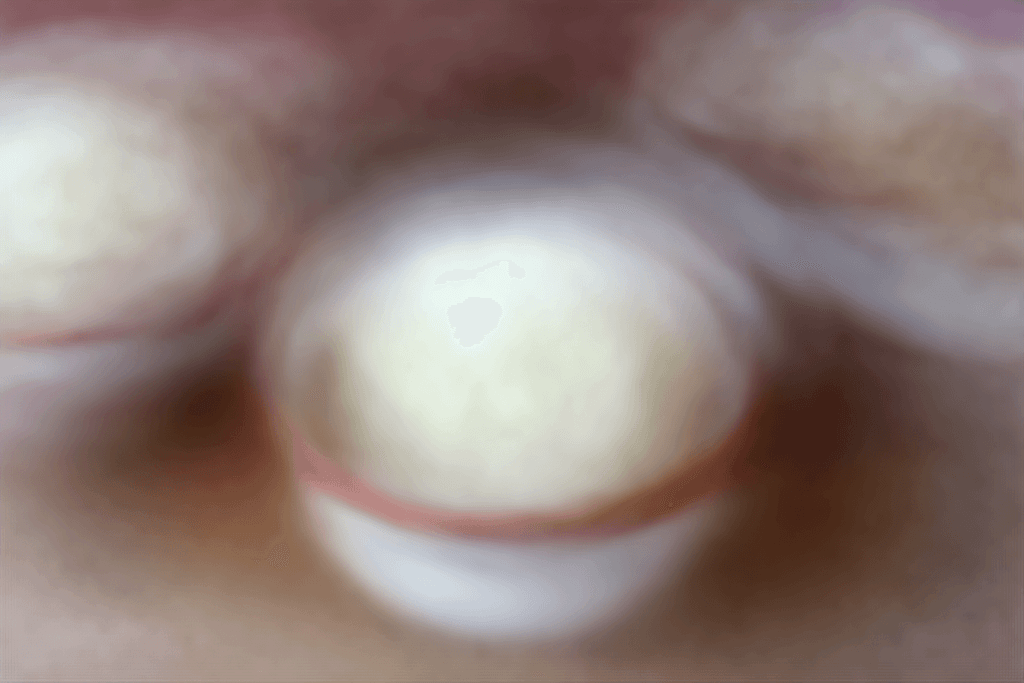 Easy No-Churn Almond Joy Ice Cream Recipe