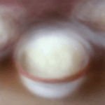 Easy No-Churn Almond Joy Ice Cream Recipe