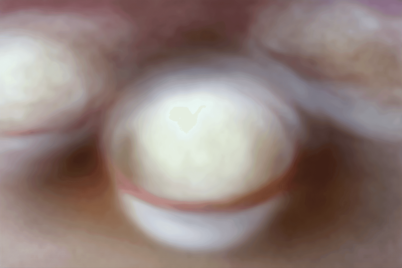 Easy No-Churn Almond Joy Ice Cream Recipe